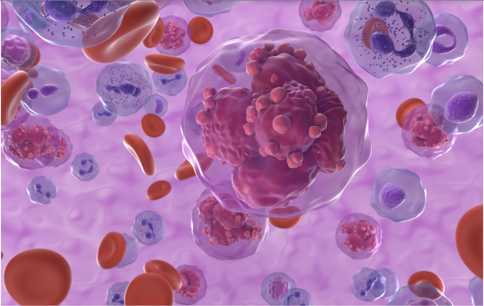Acute myeloid leukemia cells in blood flow, isometric 3D illustration