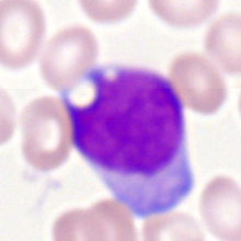 myeloblast
